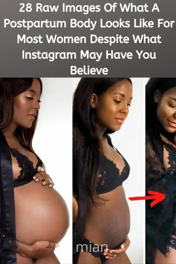 28 Raw Images Of What A Postpartum Body Looks Like For Most Women Despite What Instagram May Have..