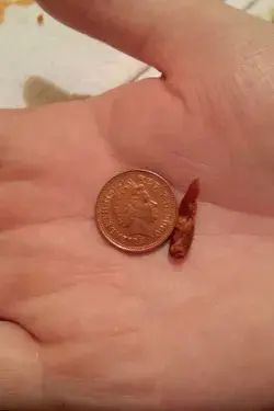 Simple Method to Remove Earwax