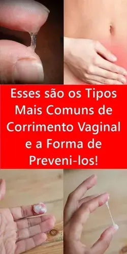 Esses são os Tipos Mais Comuns de Corrimento Vaginal e a Forma de Preveni-los!