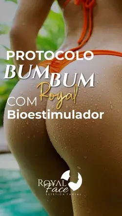 Protocolo Bumbum Royal com Bioestimuladores