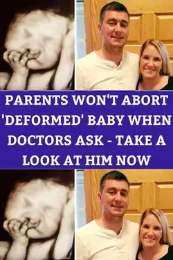 Parents Won't Abort 'Deformed' Baby When Doctors Ask - Take A Look At Him Now