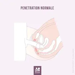 Pénétration normale VS Vaginisme