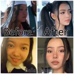 Bella Poarch nosejob and eyelid surgery