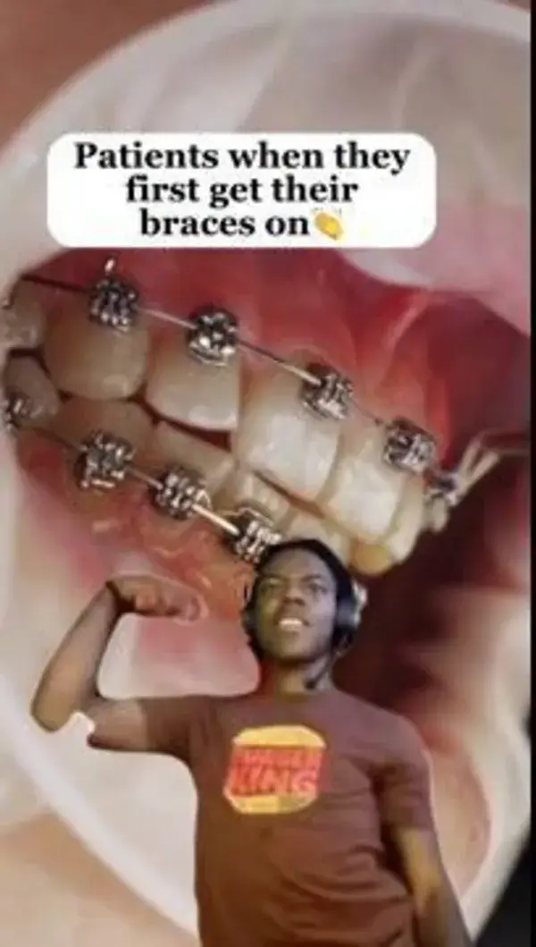 Braces tip!