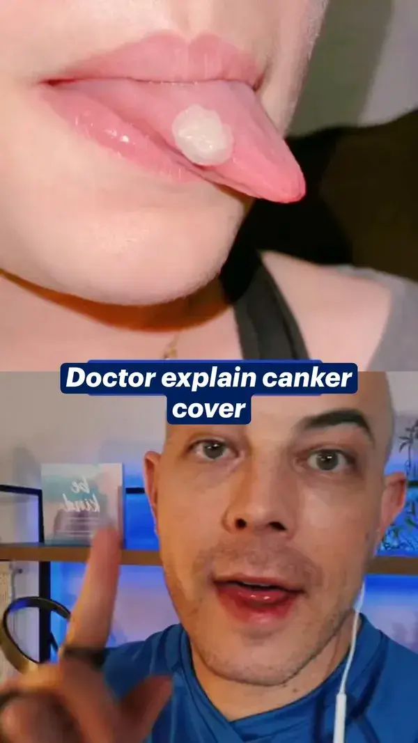 Doctor explain canker  cover