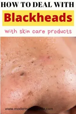 What causes blackheads and how to treat them – Modern Vintage Ville