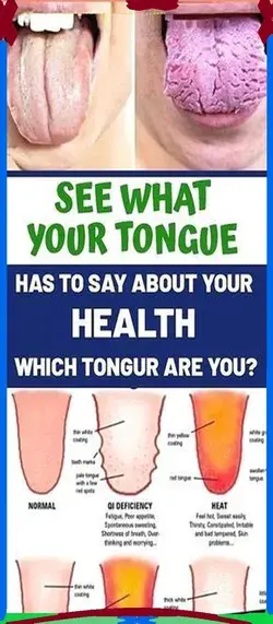 What Your Tongue is Trying to Tell You About Your Health