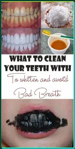 GUARANTEED TEETH WHITENING IN LESS THAN 2 MINUTES!