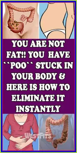 YOU ARE NOT FAT!! YOU HAVE �POO� STUCK IN YOUR BODY & HERE IS HOW TO ELIMINATE IT INSTA