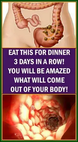 EAT THIS FOR DINNER 3 DAYS IN A ROW! YOU WILL BE AMAZED WHAT WILL COME OUT OF YOUR BODY!