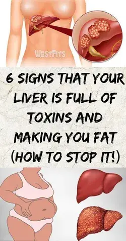 6 Warning Signs That Show Your Liver Is Full of Toxins