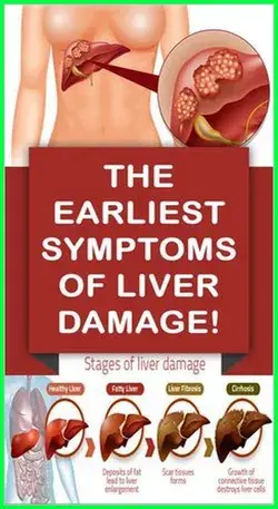 10 Warning Signals of Liver Damage You Should Not Ignore