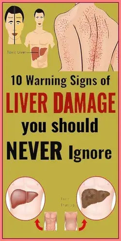 10 Warning Signals of Liver Damage You Should Not Ignore