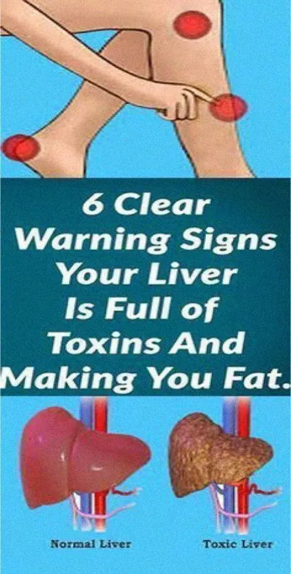 6 Warning Signs That Indicate Your Liver Is Full of Toxins