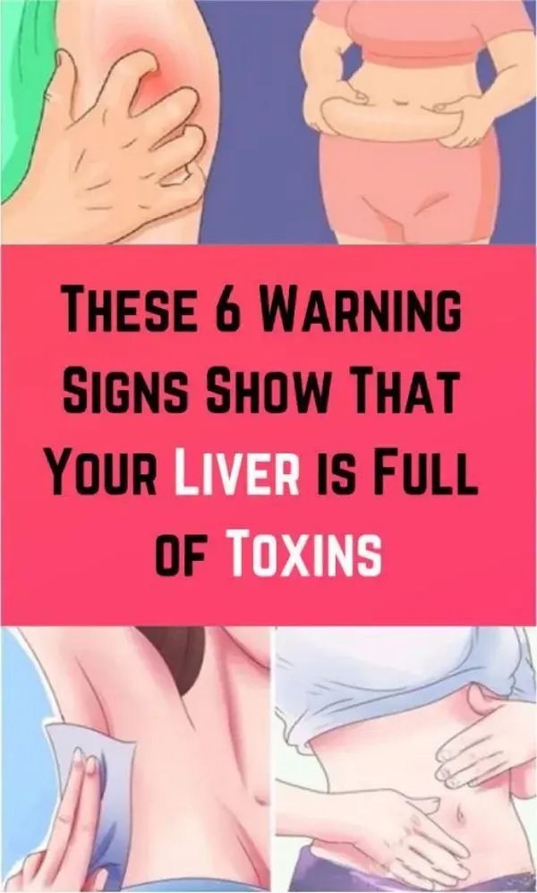 6 Signs That Your Liver Is Full Of Toxins