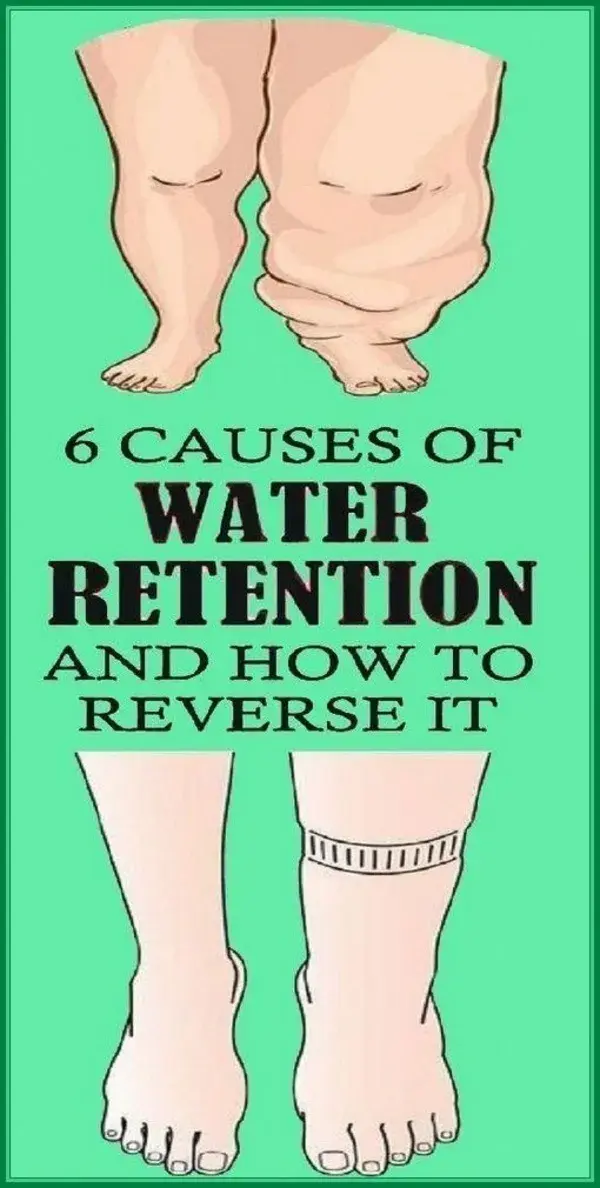 6 CAUSES OF WATER RETENTION AND HOW TO REVERSE IT