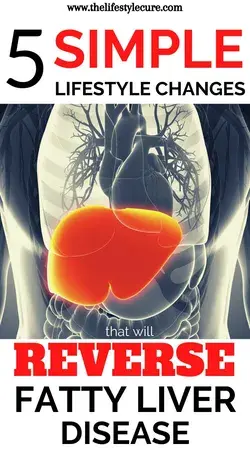 5 Simple Lifestyle Changes to Reverse Your Fatty Liver Disease!