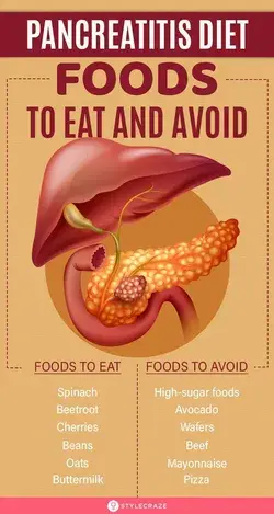 Pancreatitis Diet – Foods To Eat And Avoid