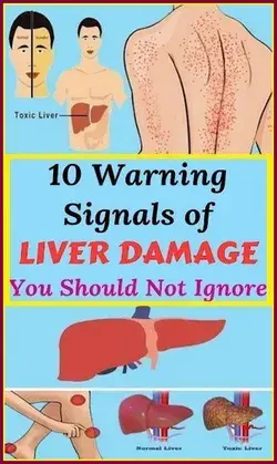 10 Warning Signals of Liver Damage You Should Not Ignore