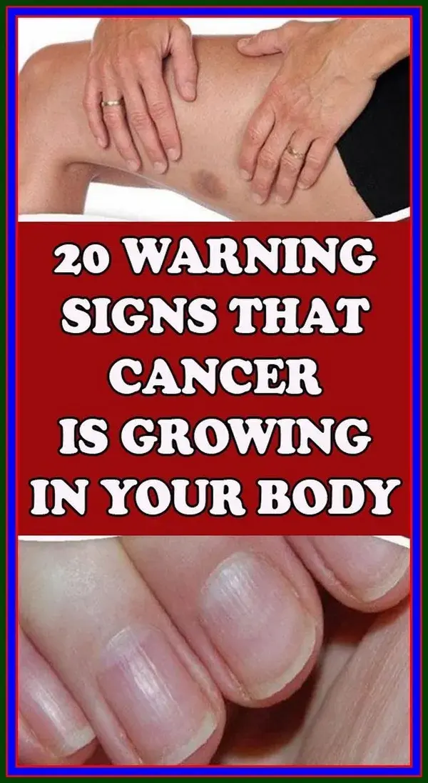 20 Warning Signs that Cancer is Growing in Your Body