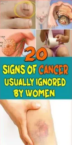 20 warning signs that cancer is growing in your body