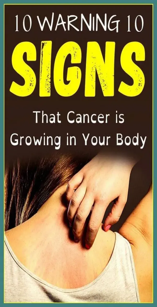 20 Warning Signs that Cancer is Growing in Your Body