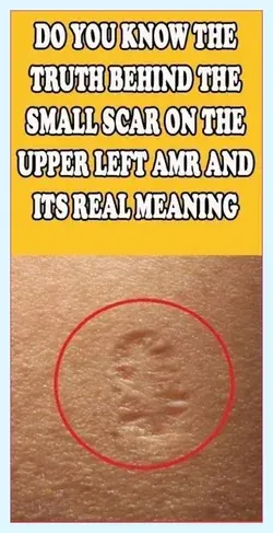 Do You Know The Truth Behind The Small Scar On The Upper Left Arm And Its Real Meaning