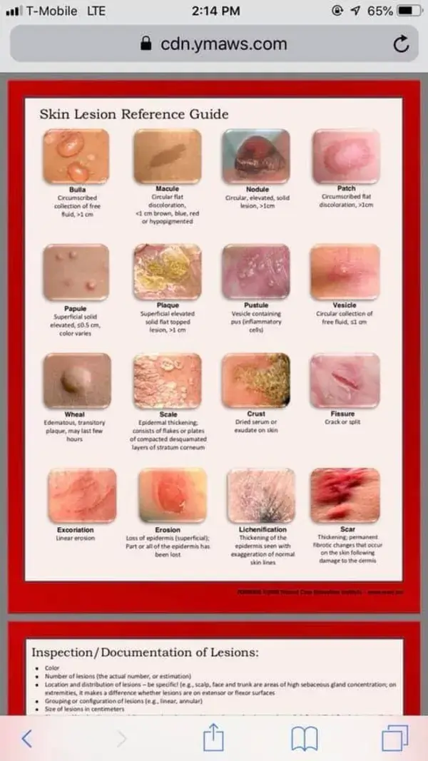 Skin lesions