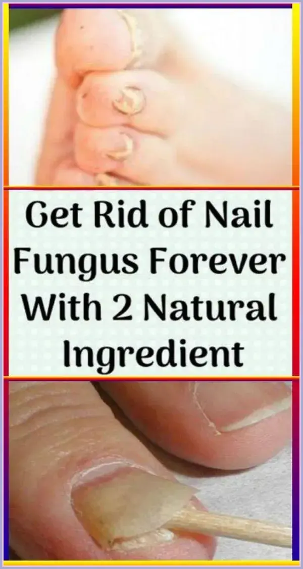 3 Simple and Effective Natural Cures for Toenail Fungus