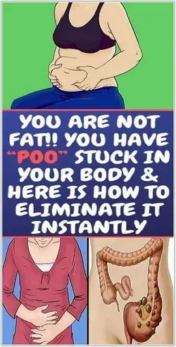 YOU ARE NOT FAT! YOU HAVE �POO� STUCK IN YOUR BODY & HERE IS HOW TO ELIMINATE IT INSTANTLY