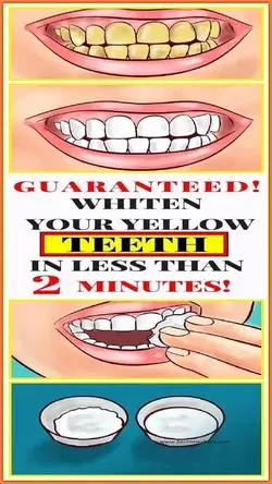 GUARANTEED! WHITEN YOUR YELLOW TEETH IN LESS THAN 2 MINUTES!