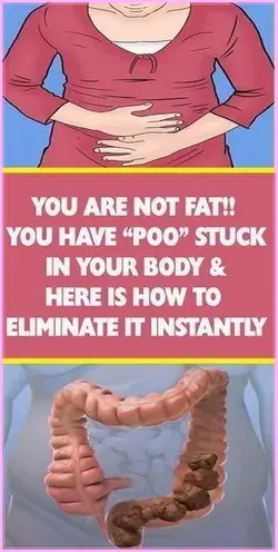 YOU HAVE ?POO? STUCK IN YOUR BODY & HERE IS HOW TO ELIMINATE IT INSTANTLY