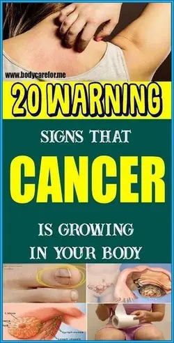 20 Warning Signs that Cancer is Growing in Your Body