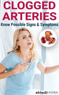 Possible Signs and Symptoms of Clogged Arteries