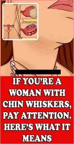 IF YOU�RE A WOMAN WITH CHIN WHISKERS, PAY ATTENTION. HERE�S WHAT IT MEANS!