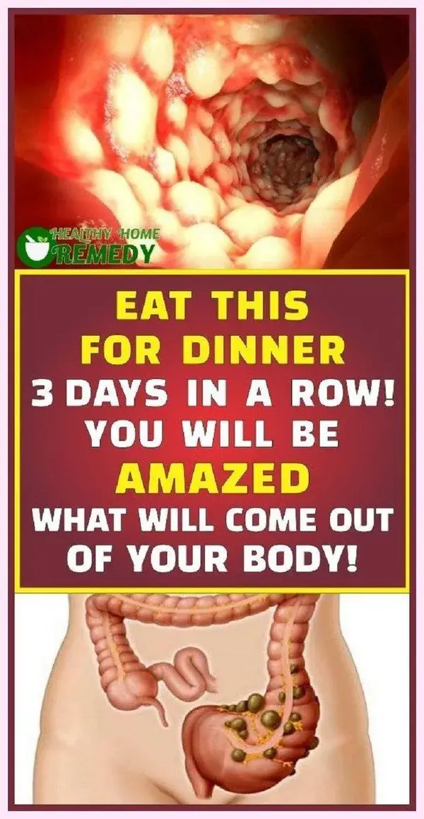 Eat This Dinner 3 Days in a Row! You Will Be Amazed What Will Come Out of Your Body!