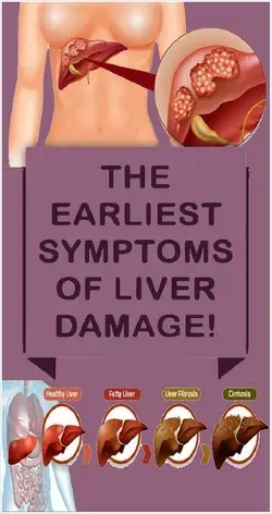 10 Warning Signals of Liver Damage You Should Not Ignore