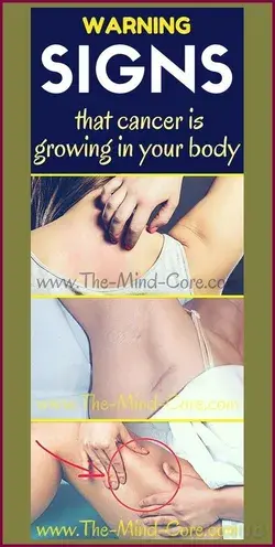 EARLY WARNING SIGNS THAT CANCER IS GROWING IN YOUR BODY!