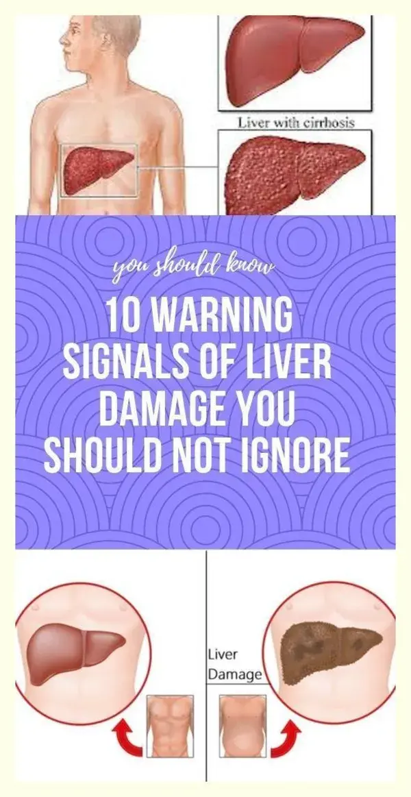 10 Warning Signals of Liver Damage You Should Not Ignore