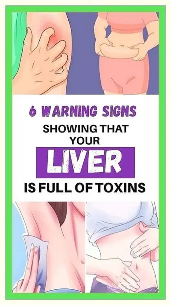 6 Signs That Your Liver Is Full Of Toxins