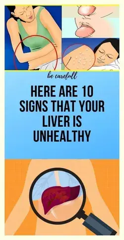 10 Warning Signals of Liver Damage You Should Not Ignore