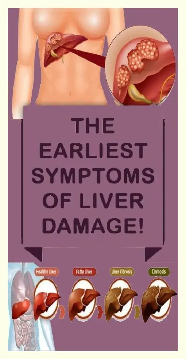 10 Warning Signals of Liver Damage You Should Not Ignore