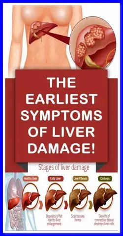 Early Symptoms Of Liver Damage That Everyone Ignores