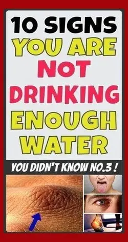 10 SIGNS YOU ARE NOT DRINKING ENOUGH WATER