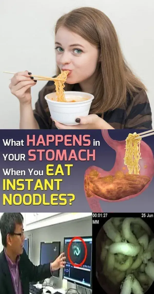 This is What Happens Inside Your Stomach When You Eat Instant Noodles!