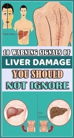 10 Warning Signals of Liver Damage You Should Not Ignore