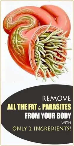 Remove All the Fat and Parasites from Your Body With Only 2 Ingredients!