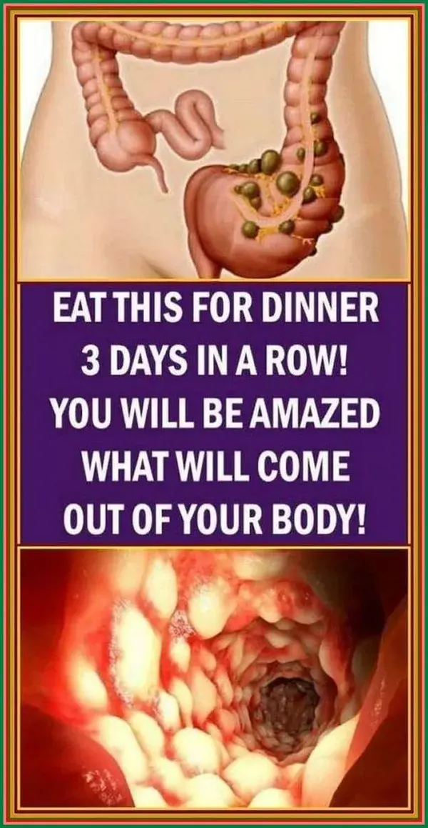 EAT THIS FOR DINNER 3 DAYS IN A ROW! YOU WILL BE AMAZED WHAT WILL COME OUT OF YOUR BODY!