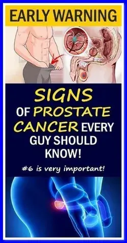 Early warning Sign of prostate cancer every guy should know