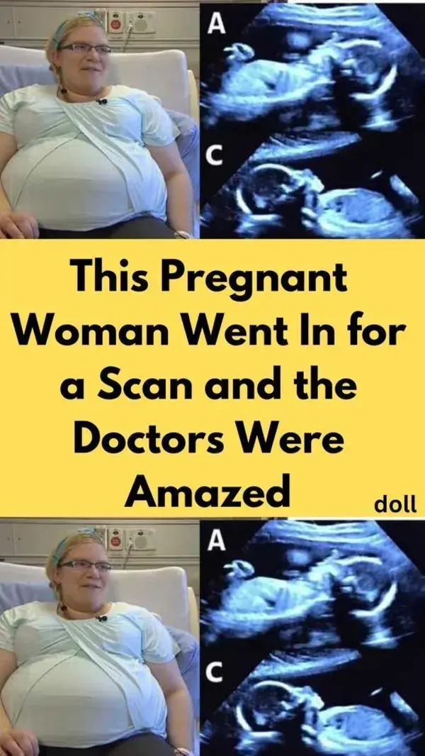 This Pregnant Woman Went In for a Scan and the Doctors Were Amazed